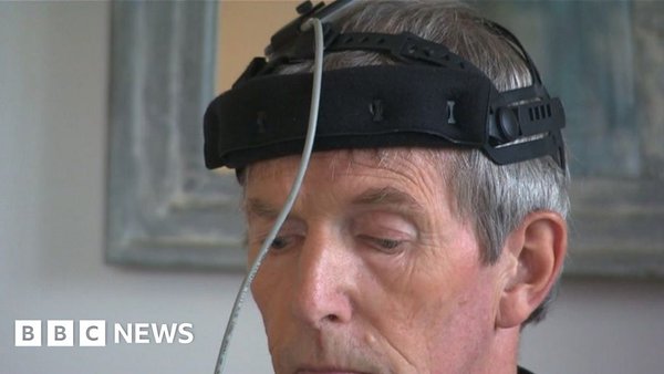 Parkinson's disease symptoms 'reversed' by mini implant, trial suggests